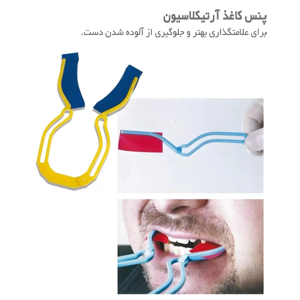 پنس کاغذ آرتی کلاسیون در حال استفاده پنس کاغذ آرتی کلاسیون برای معاینات و تنظیم اکلوژن