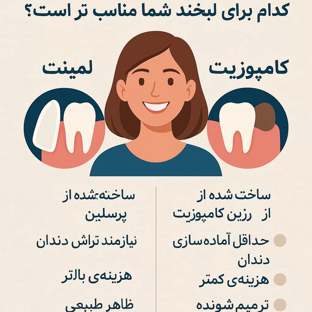 تفاوت لمینت و کامپوزیت